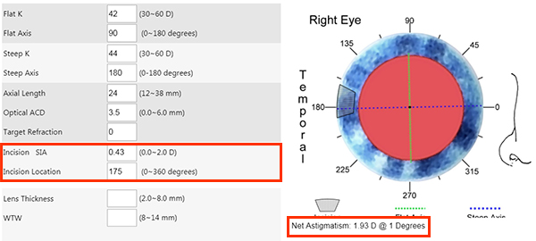 bigsia-clculo-del-astigmatismo-corneal-inducido-por