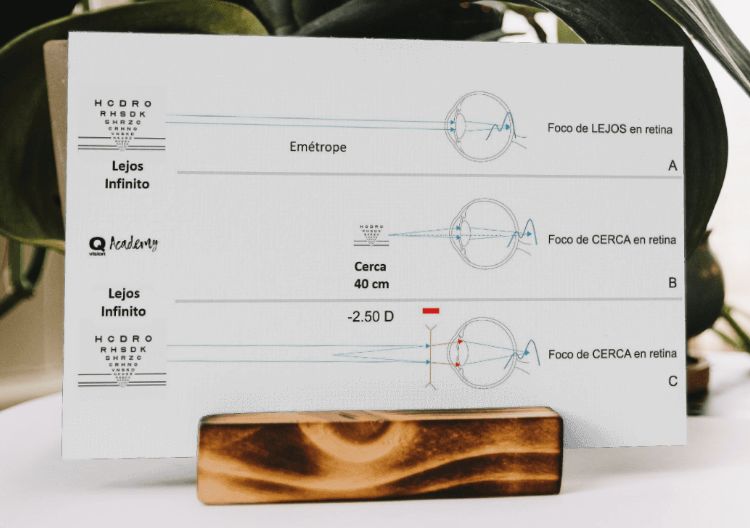 Preparando las lentes para medir una Curva de Desenfoque